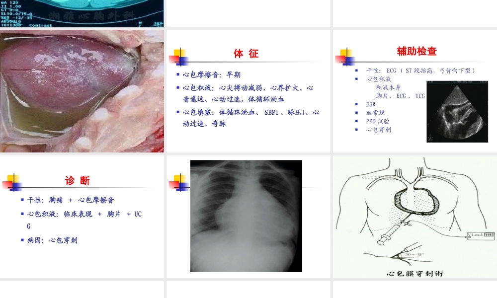 循环系统疾病-心包疾病