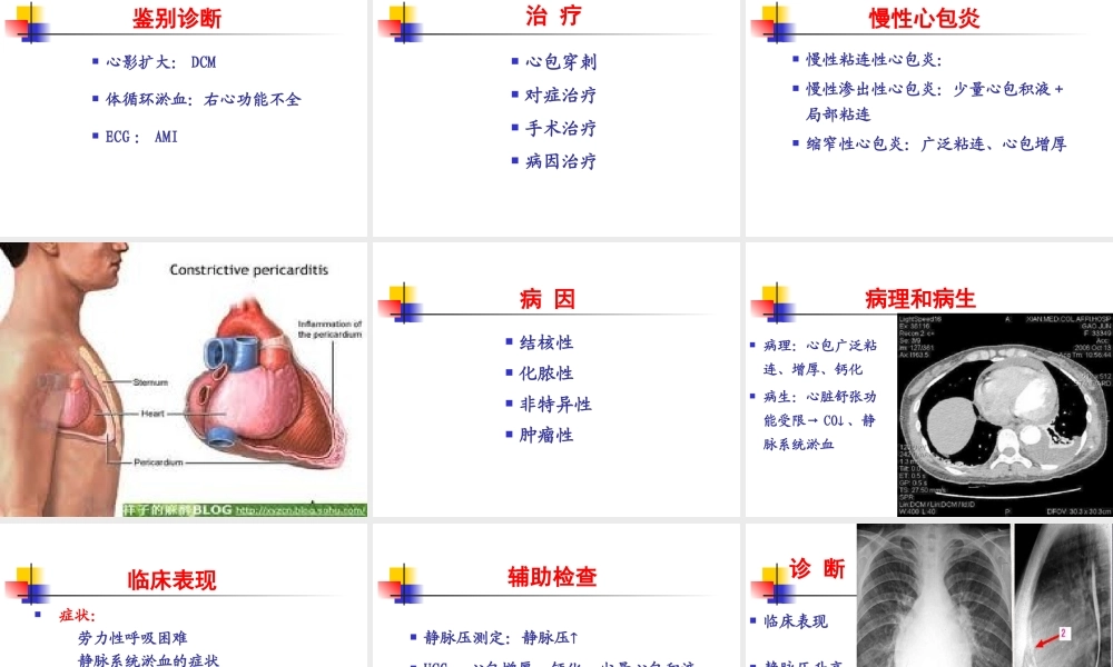 循环系统疾病-心包疾病