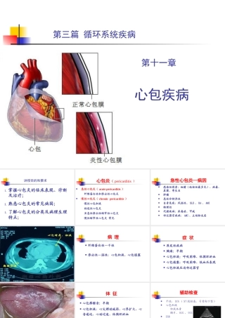 循环系统疾病-心包疾病