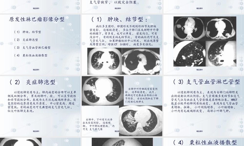 肺淋巴瘤课件