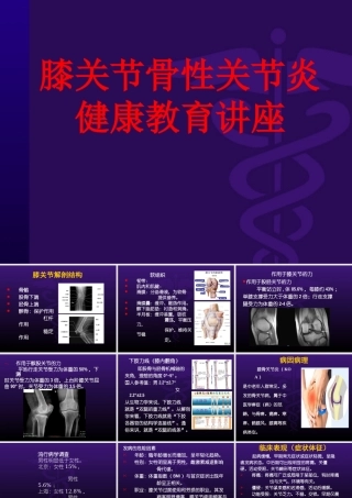膝关节骨性关节炎健康教育讲座课件