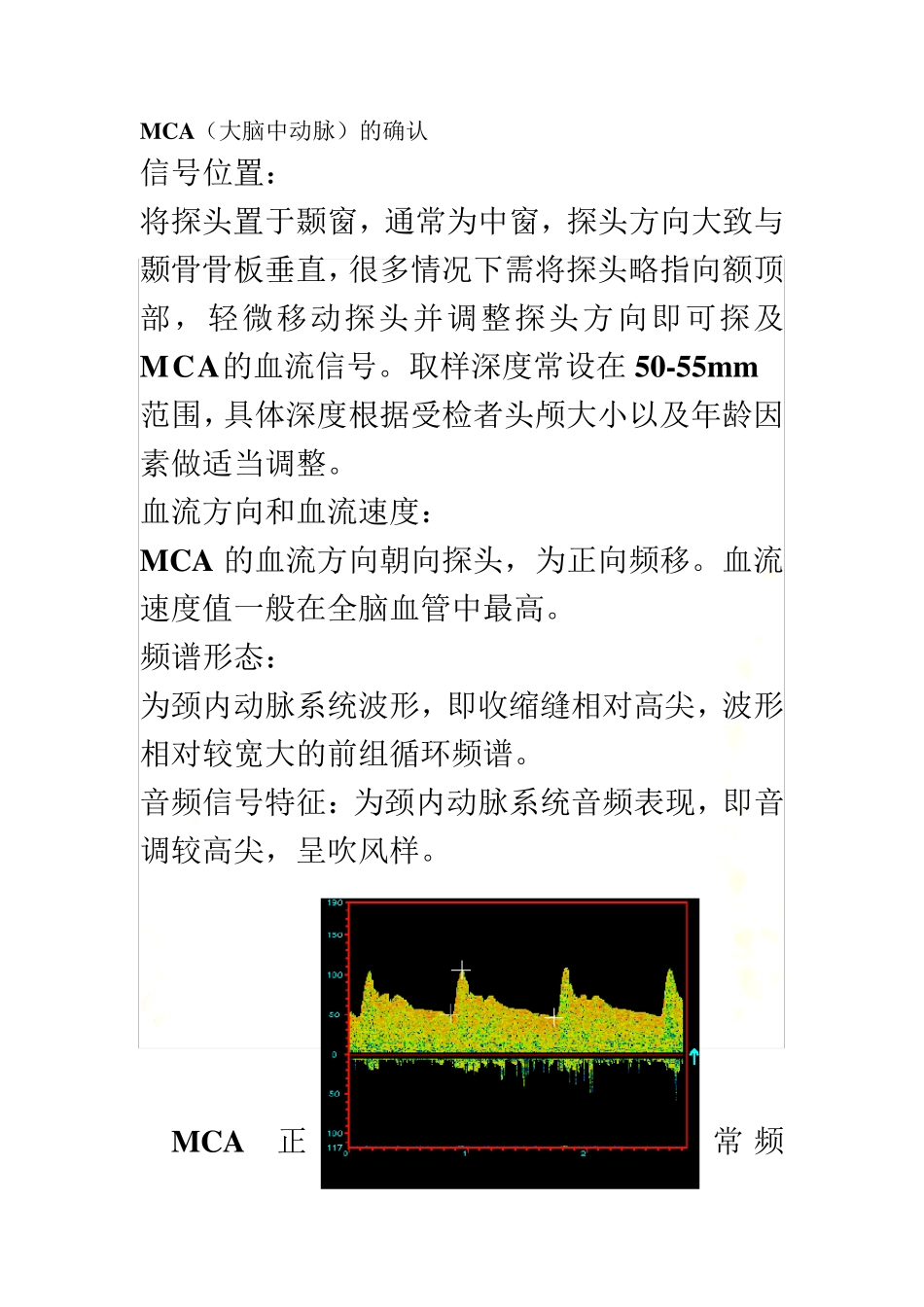 TCD各血管的辨别-位置_第2页