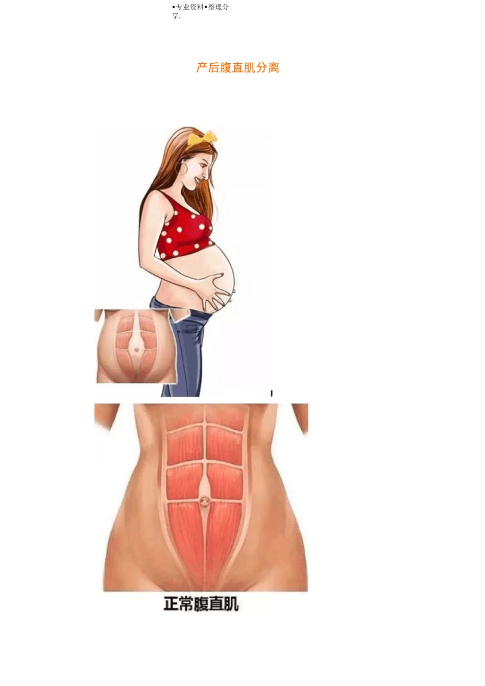 腹直肌分离的预防及治疗_第1页