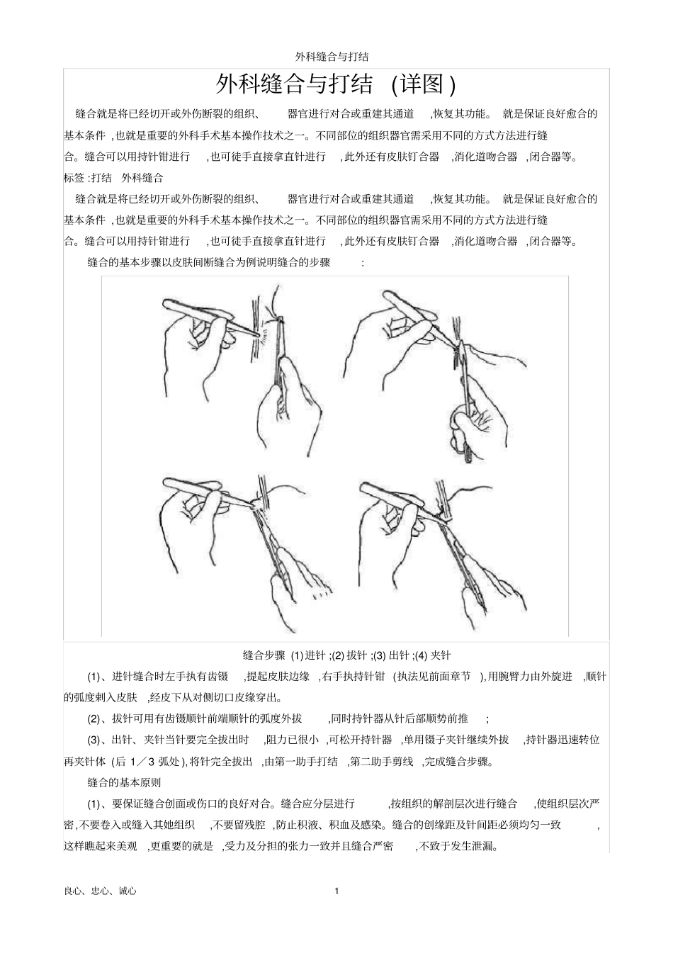 外科缝合与打结_第1页
