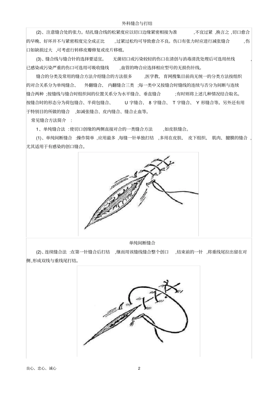 外科缝合与打结_第2页