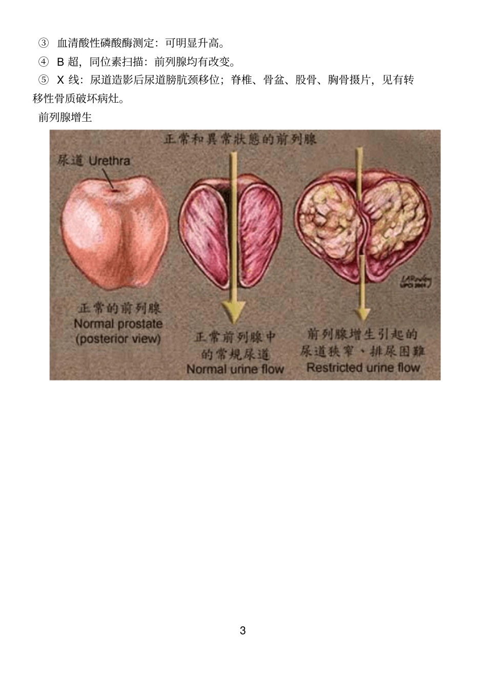 外联部使用男科专业的知识_第3页