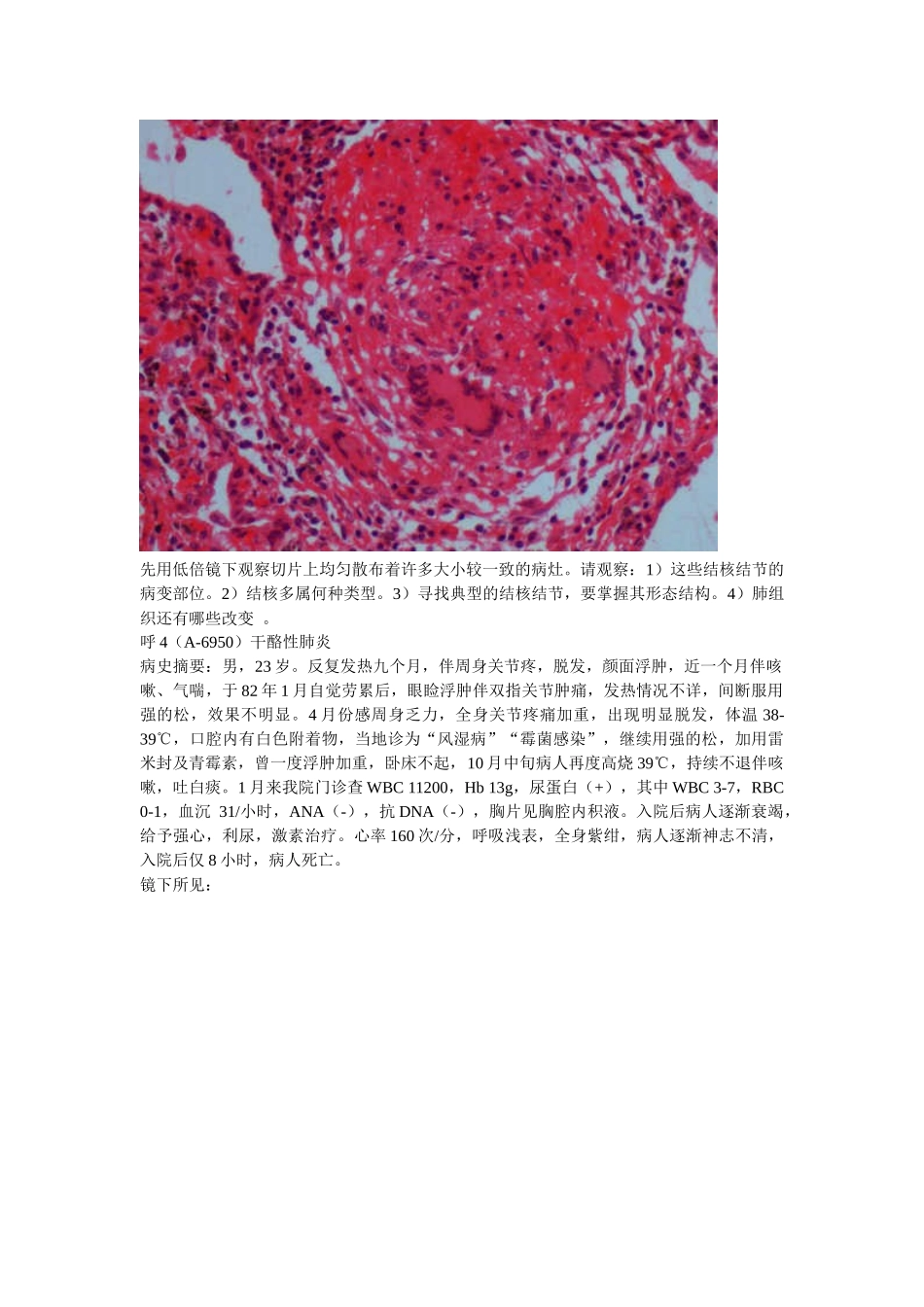中国协和医科大学病理教学呼吸系统疾病实习指导_第3页