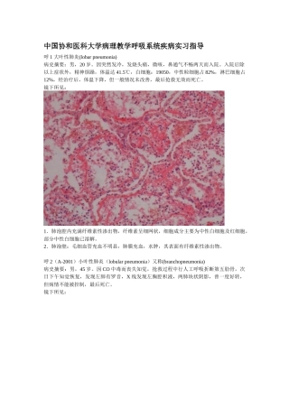 中国协和医科大学病理教学呼吸系统疾病实习指导