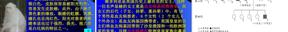人教版必修二第五章第三节遗传病和人类健康（共27张PPT）