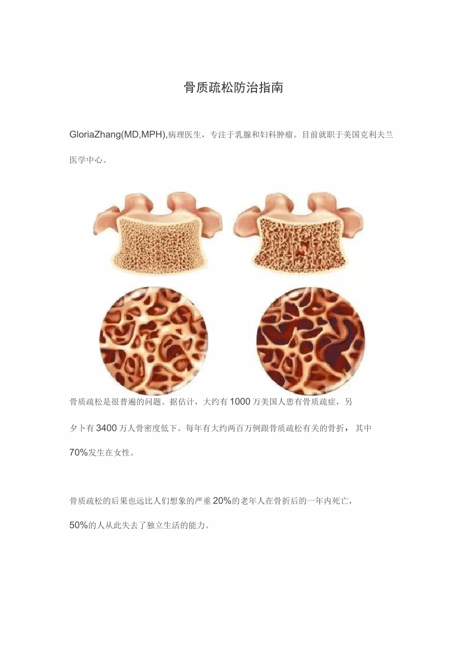 骨质疏松预防指南_第1页