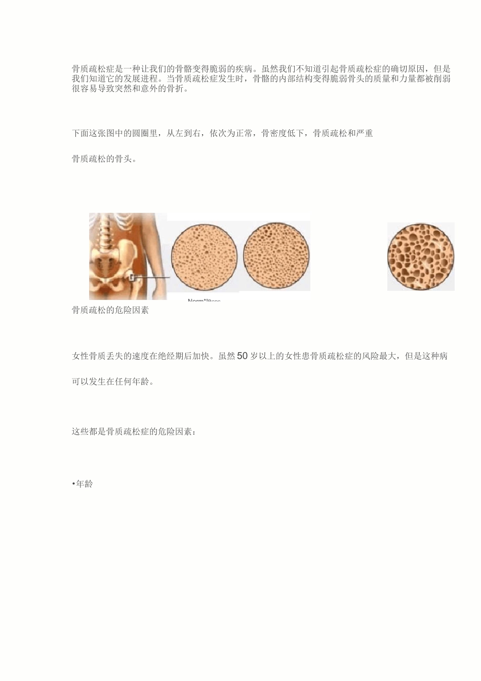 骨质疏松预防指南_第3页