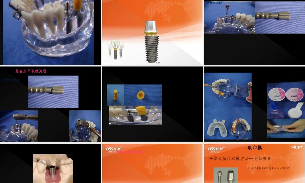 奥齿泰修复取模