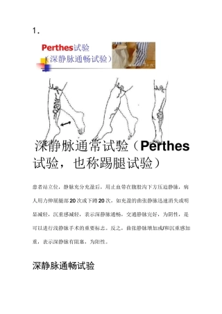 下肢静脉曲张三种检查方法.