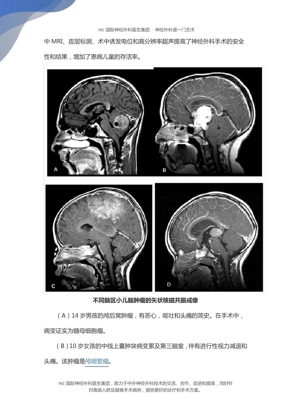 儿童低级别与高级别胶质瘤的诊断治疗_第3页