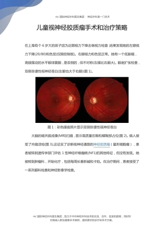 儿童视神经胶质瘤手术和治疗策略