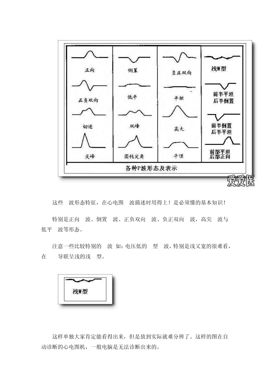 第四讲P波方向来源分析_第2页
