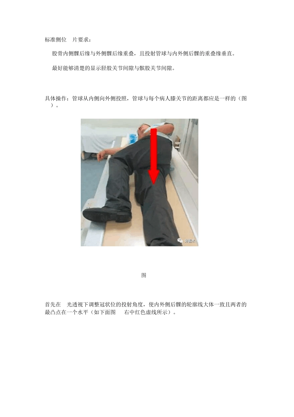 超详细的膝关节X线解剖及测量_第3页