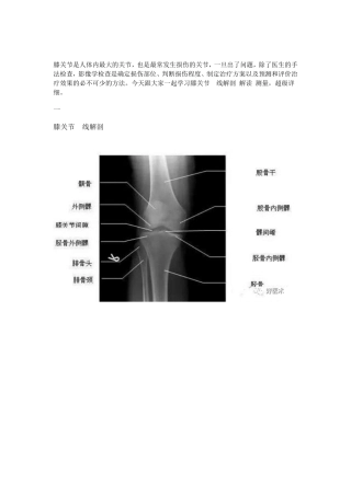 超详细的膝关节X线解剖及测量