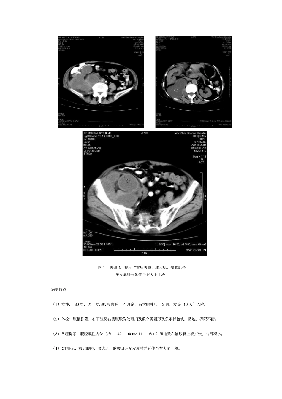 实用临床基础课程病例模板1_第2页