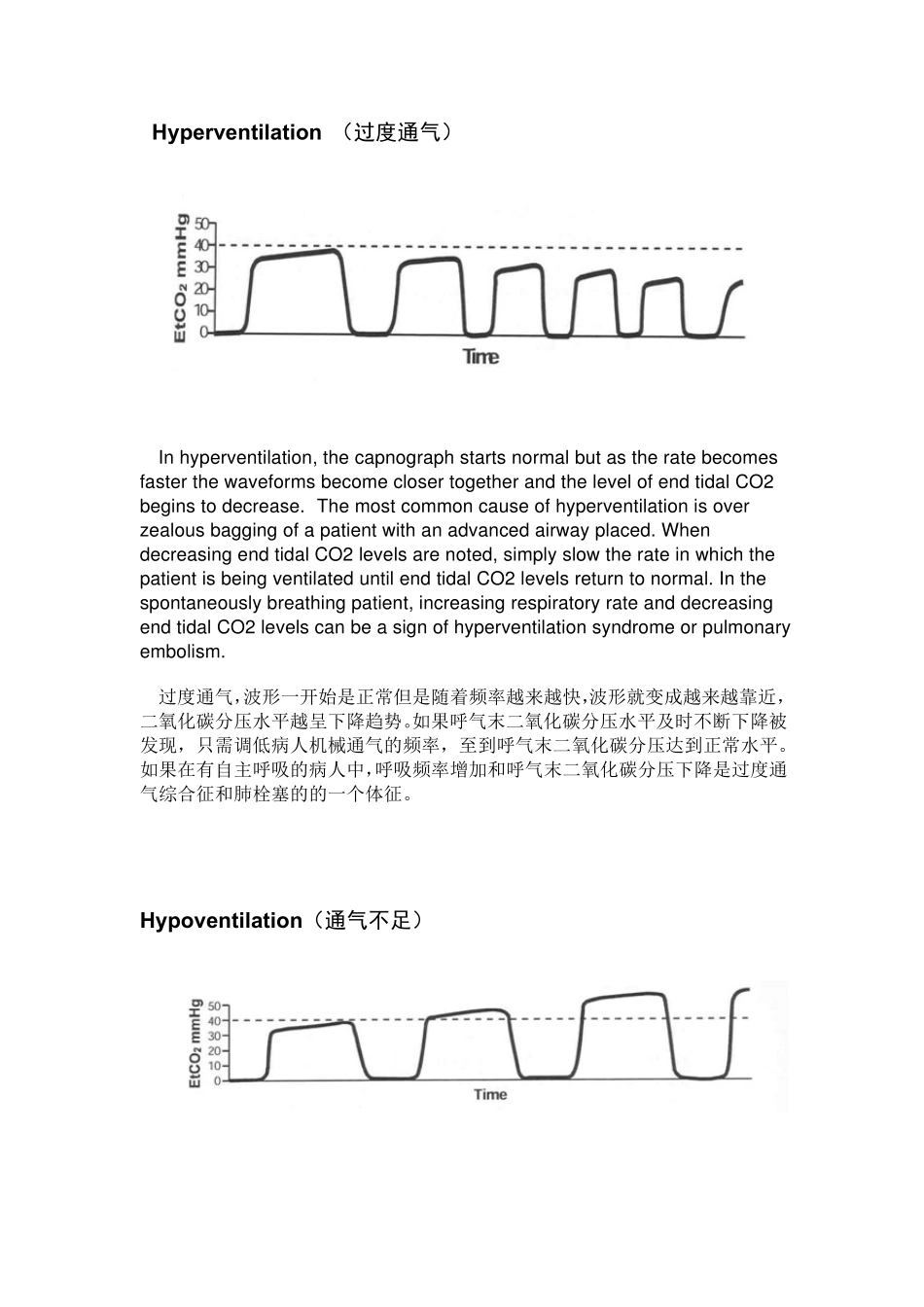 PETCO2波形图_第2页