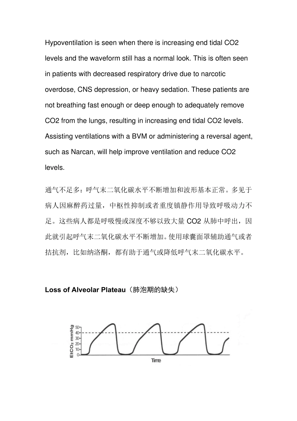 PETCO2波形图_第3页