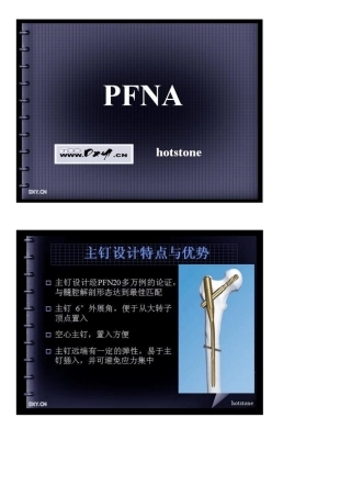 PFNA讲座