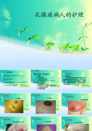 乳腺癌病人的护理