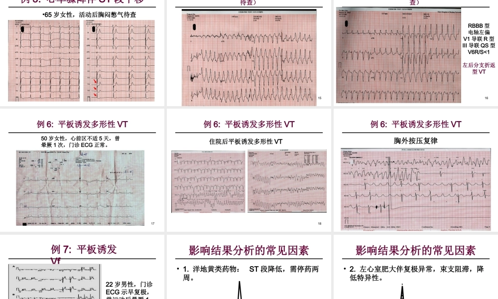 平板运动试验指南
