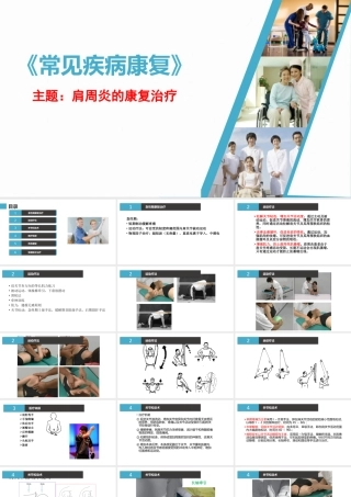 肩周炎的康复治疗