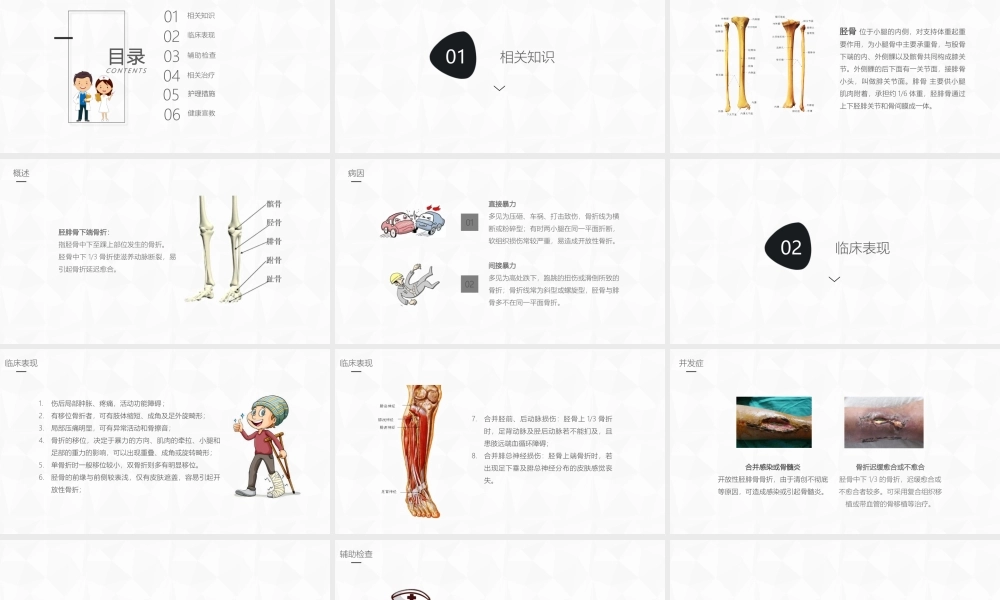 胫腓骨骨折护理课件