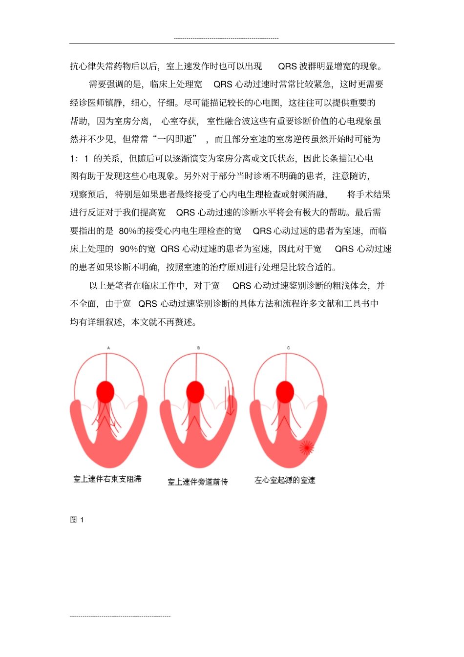 宽QRS心动过速鉴别诊断研究_第3页