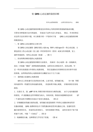 宽QRS心动过速鉴别诊断研究