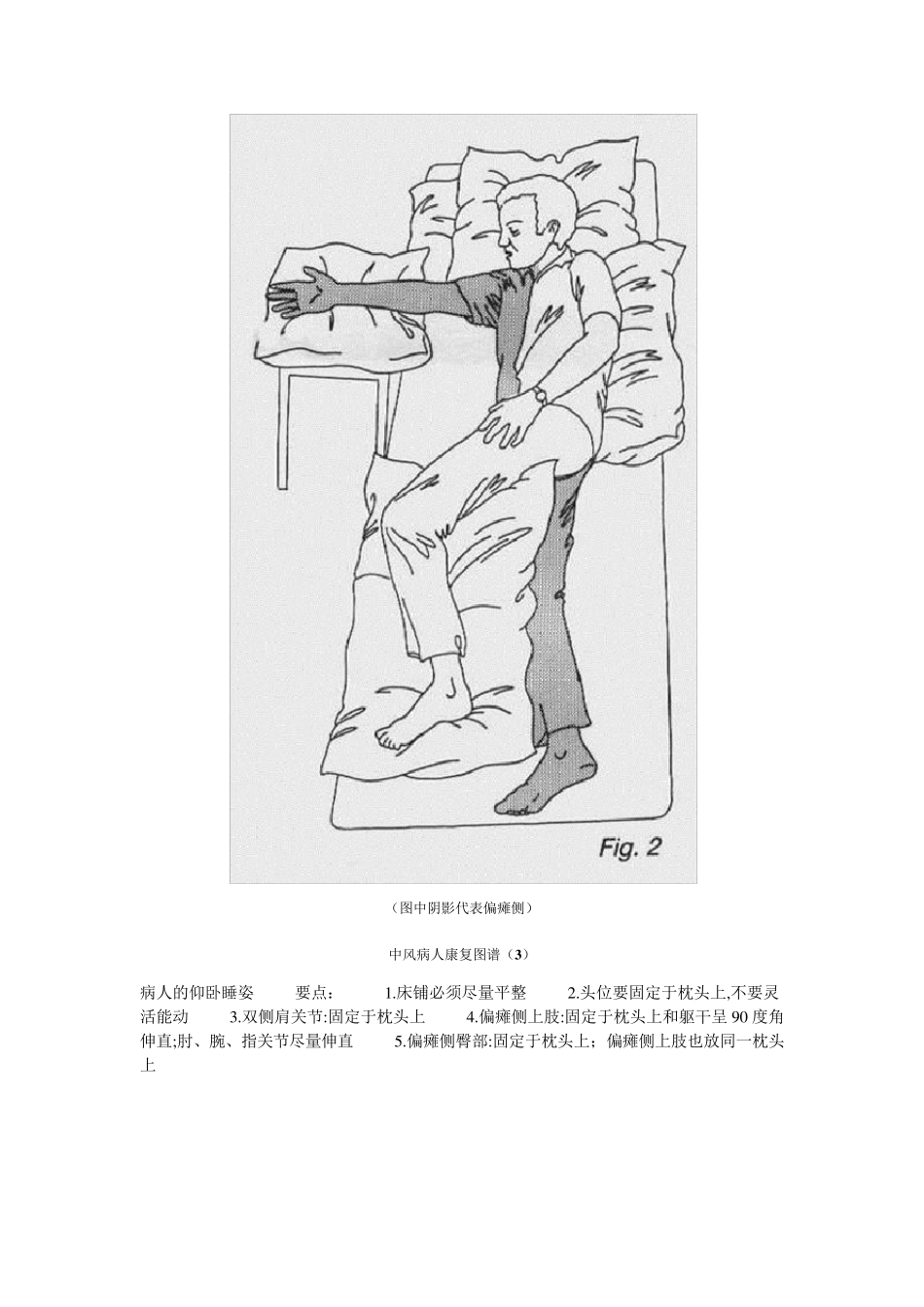 中风病人康复训练实用手册_第2页