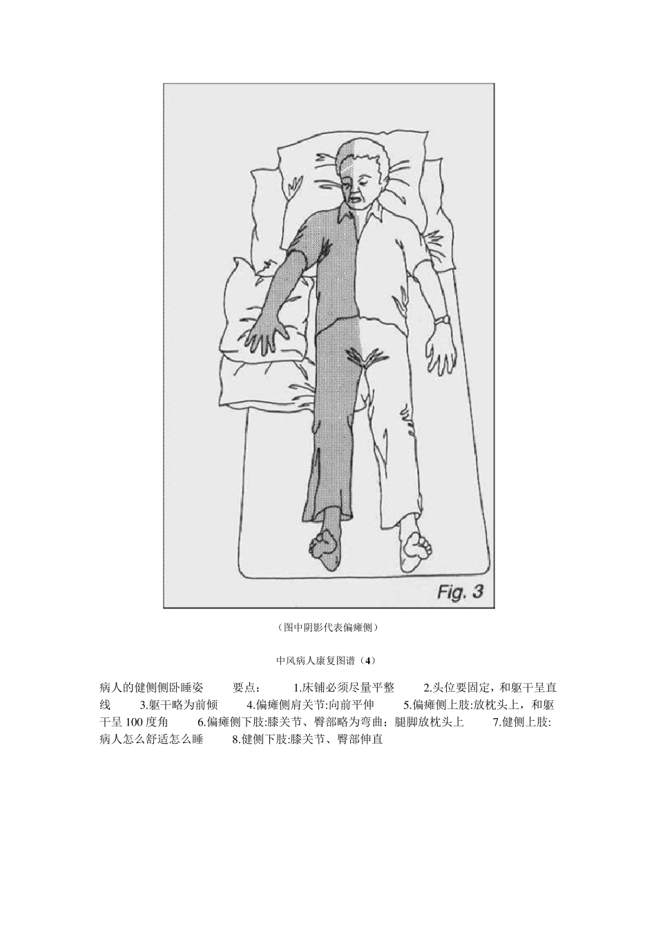 中风病人康复训练实用手册_第3页
