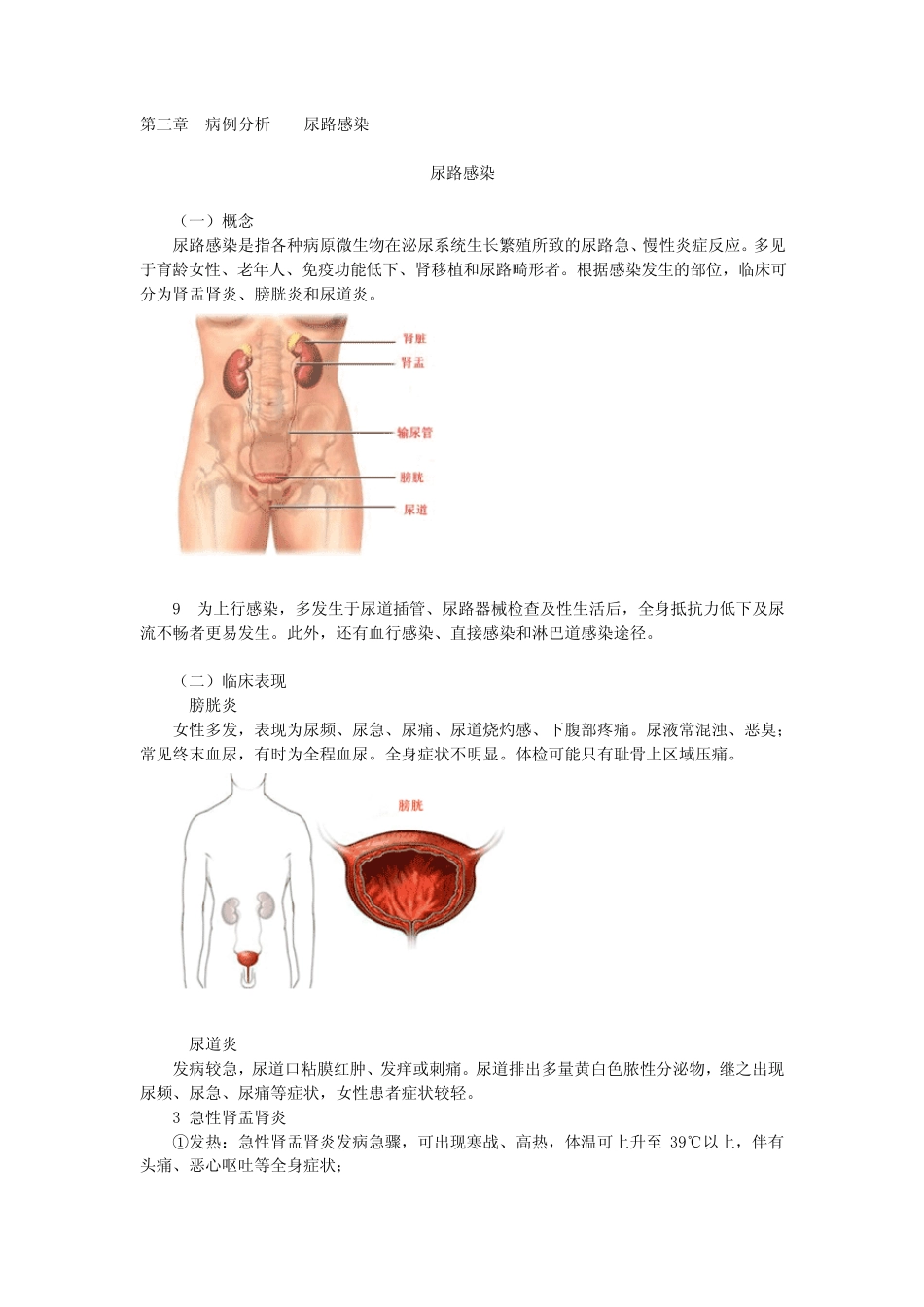 临床医师考试病例分析—尿路感染—细菌性痢疾—心力衰竭—肺炎—慢性阻塞性肺疾_第1页