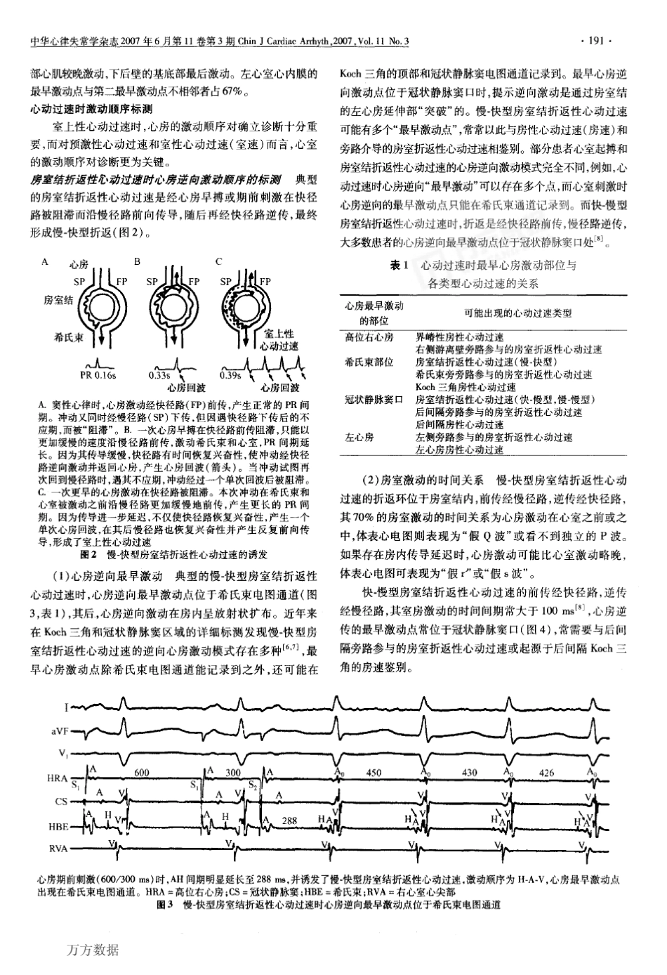 临床心脏电生理检查的标测技术_第2页