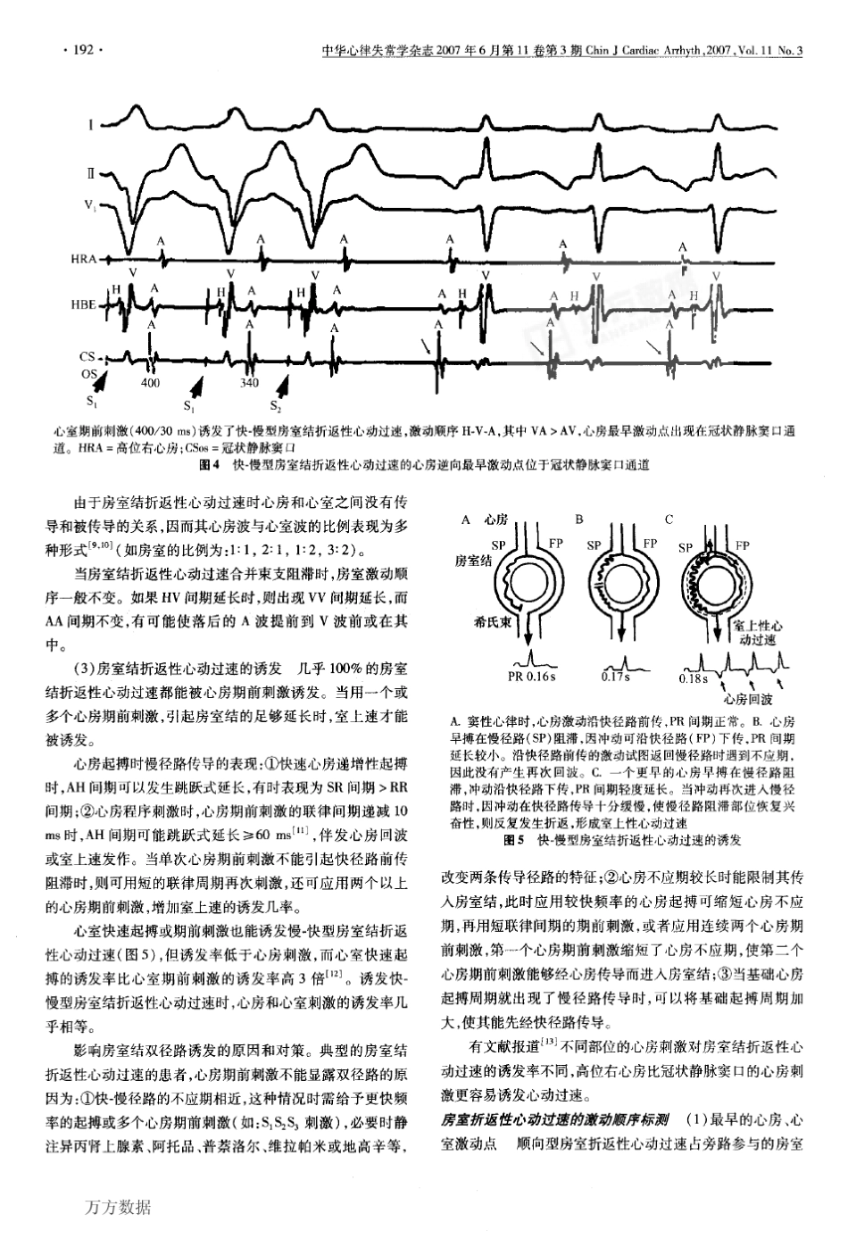 临床心脏电生理检查的标测技术_第3页