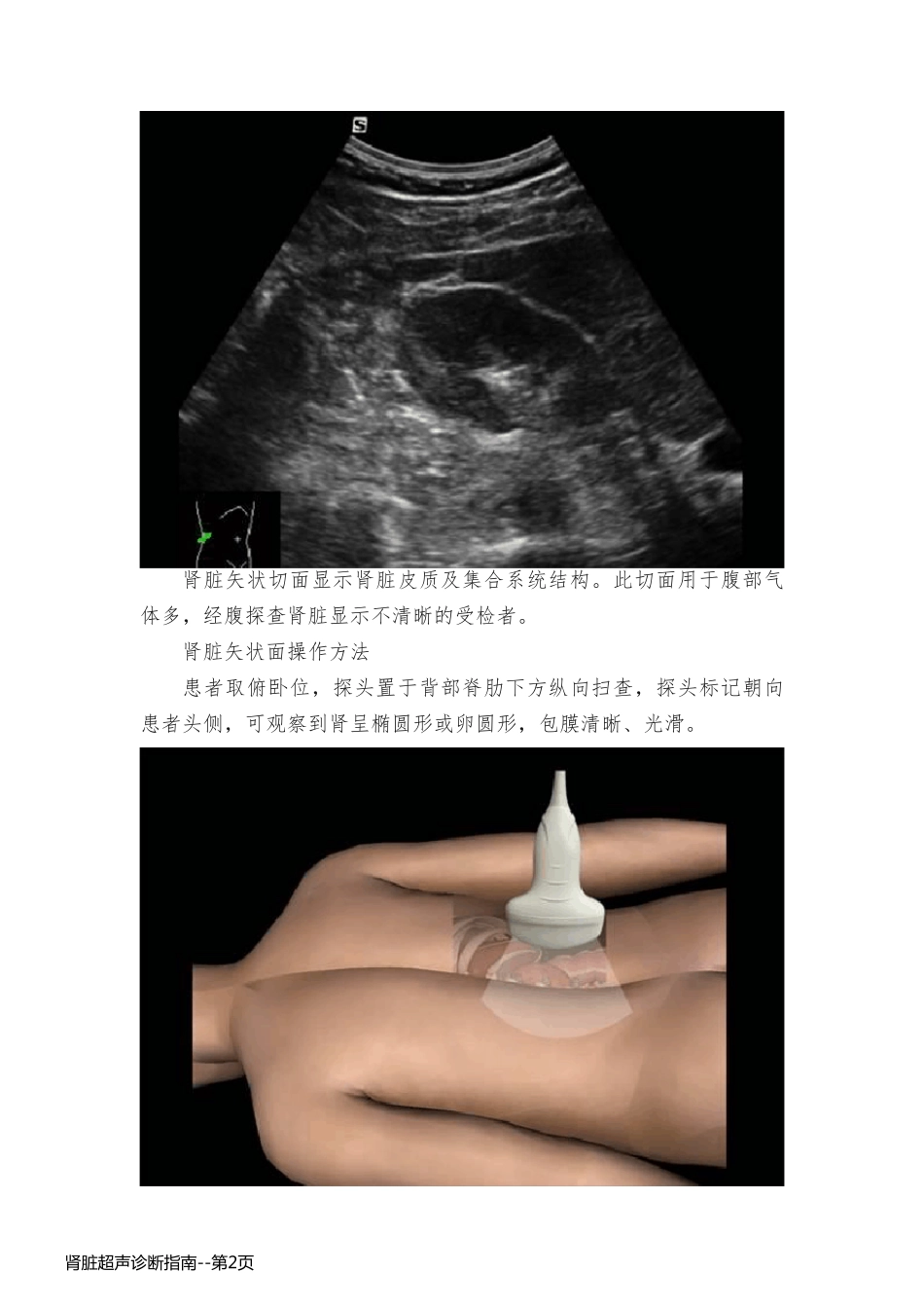 肾脏超声诊断指南_第2页