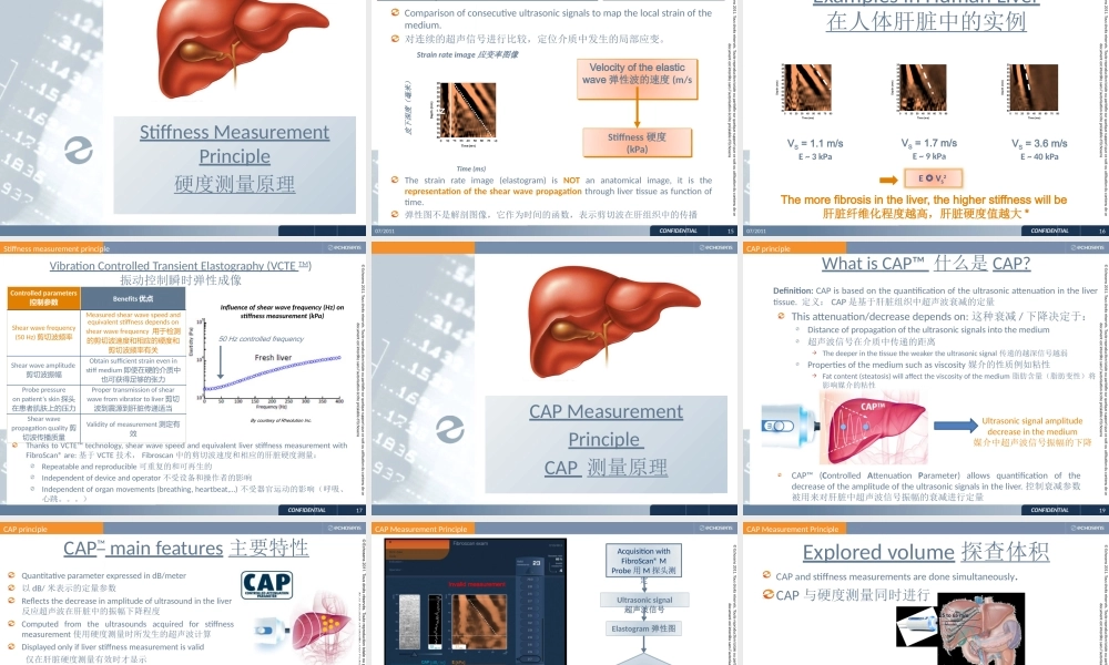 FibroScan使用方法说明