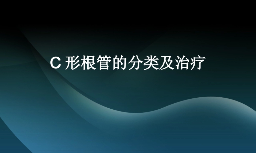 C形根管的分类及治疗