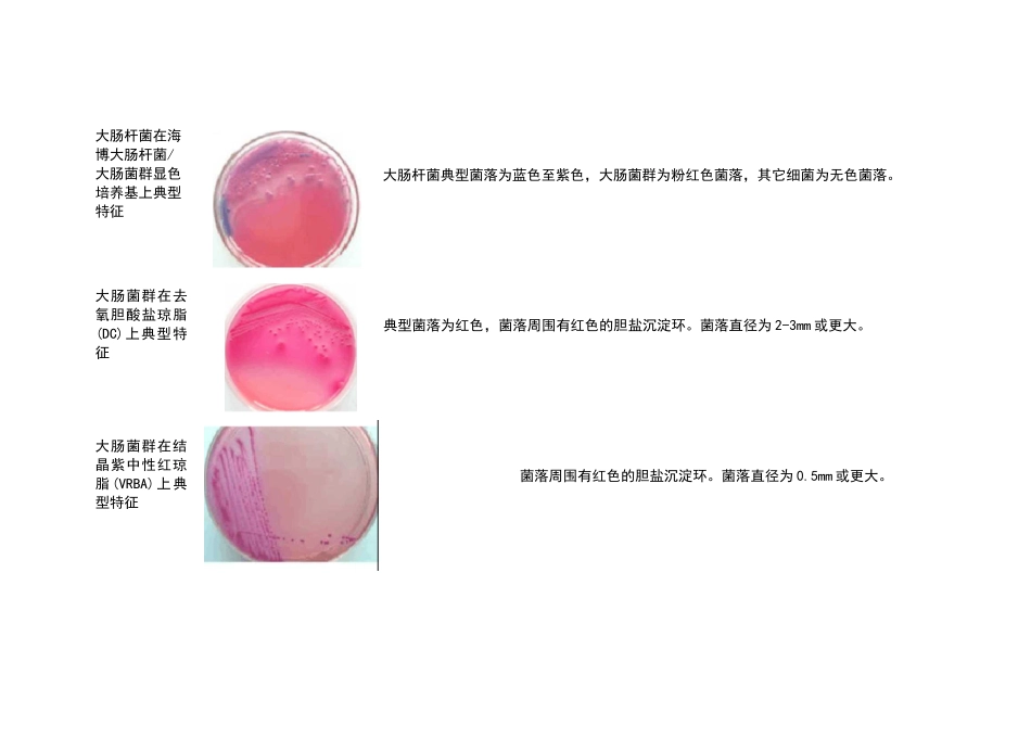 微生物菌落特征形态总结大全_第3页