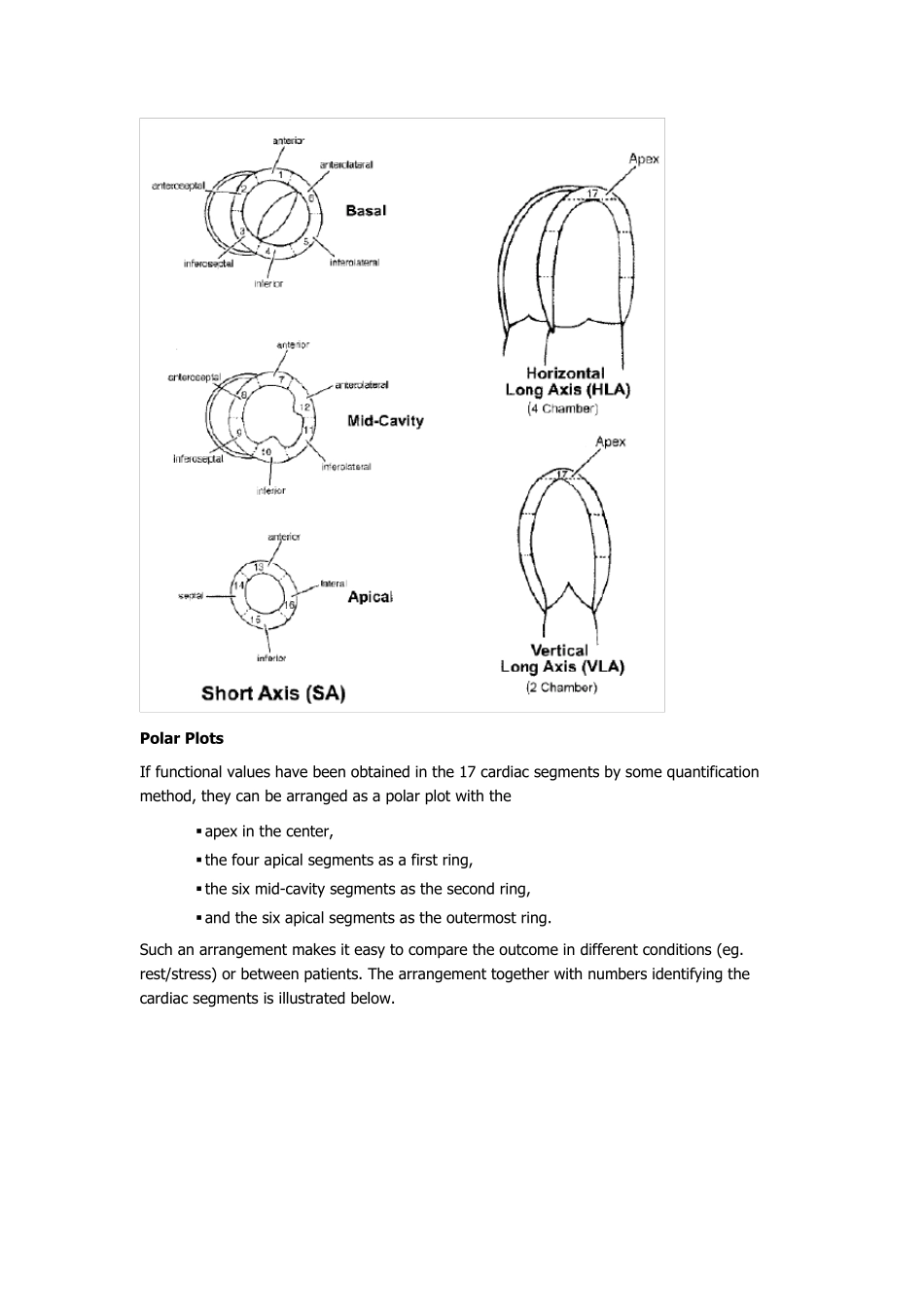 左室17节段分法_第2页