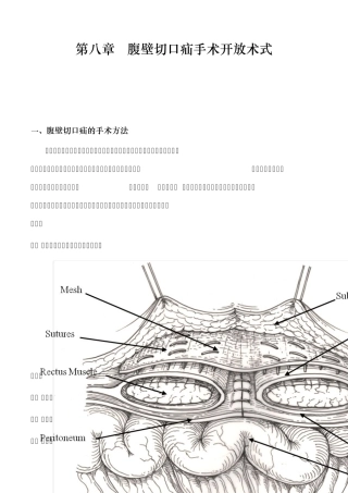 巴德腹壁切口疝手术开放术式