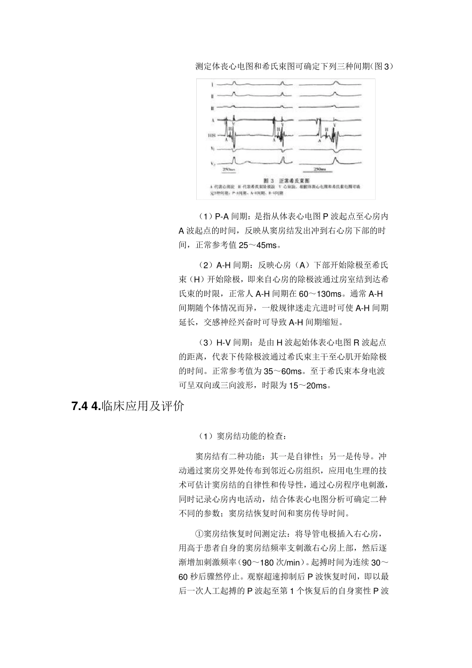 希氏束电图及电生理学检查_第2页