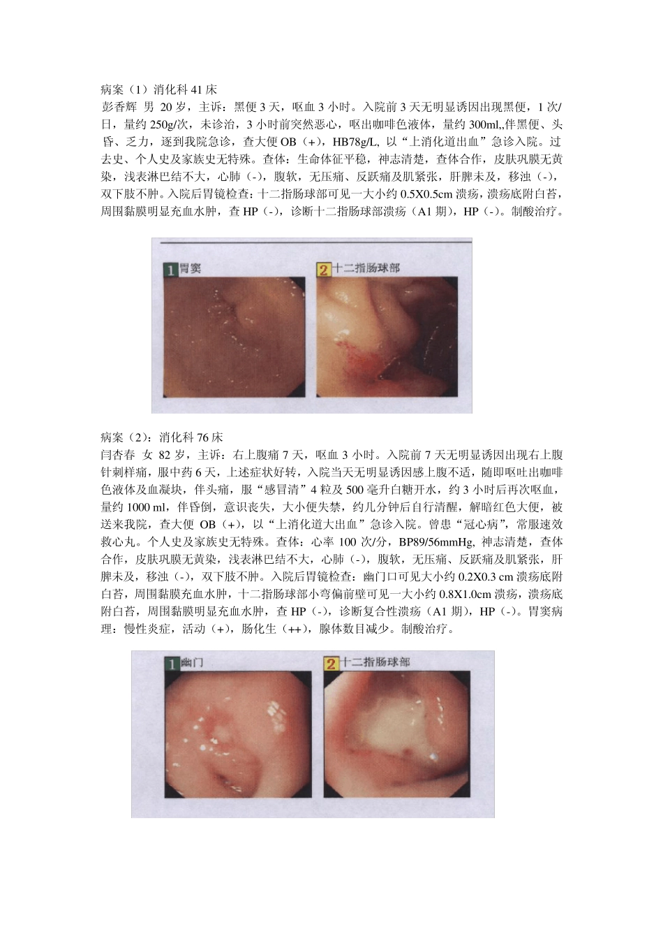 消化性溃疡典型病案_第1页