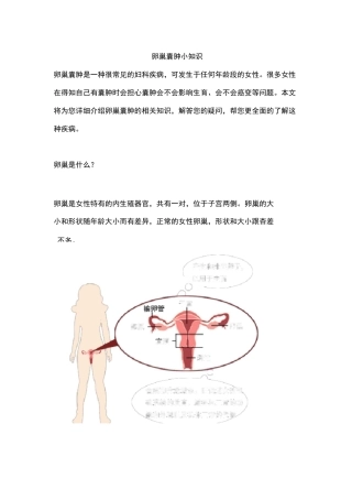 卵巢囊肿小知识