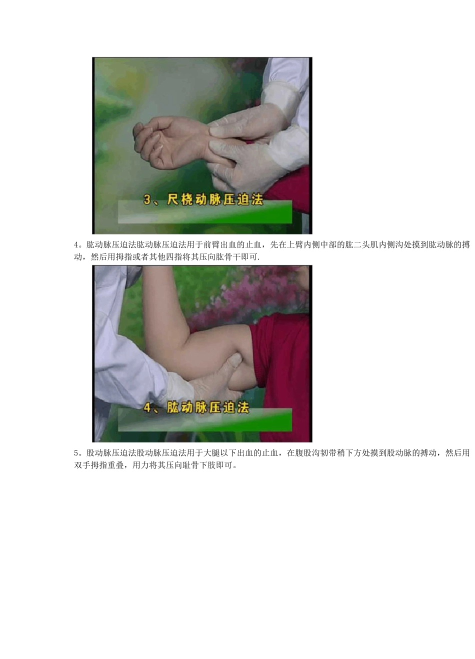 外伤现场急救技术--止血、包扎_第3页