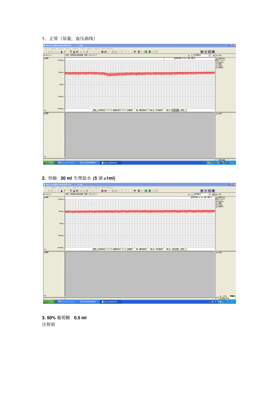 尿生成影响因素_第1页