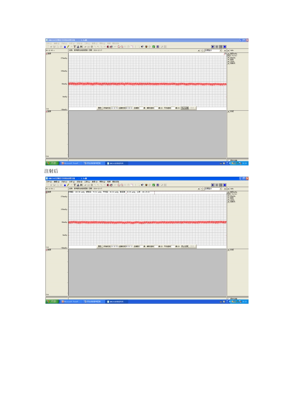 尿生成影响因素_第2页