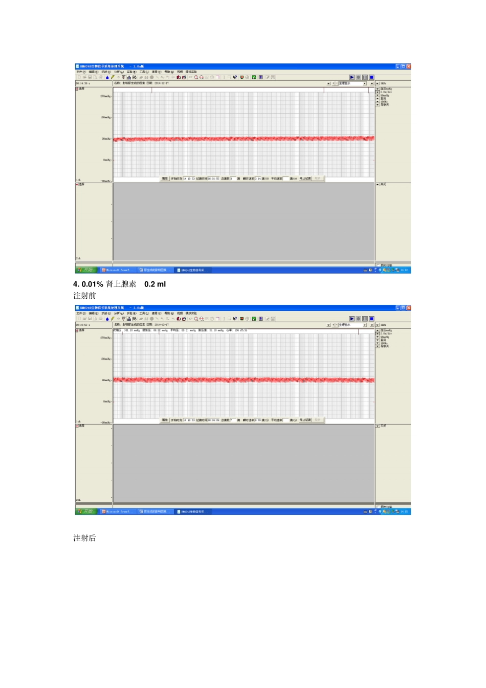 尿生成影响因素_第3页